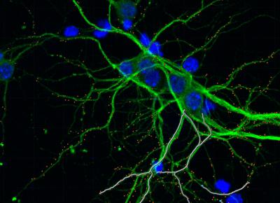 hippocampal neurons co-cultured with glioma cells