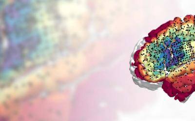 Heatmap demonstrating regions of tumor infiltration and electrode coverage