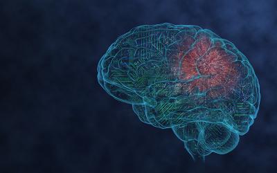 Illustration depicting how tumor cells form connections with neurons to promote their growth.